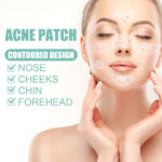 Gentle and Non-irritating Facial Acne Patch - Image 2
