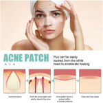 Gentle and Non-irritating Facial Acne Patch - Image 3